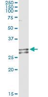 Anti-NDUFS3 Antibody Pair