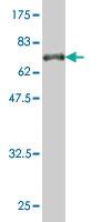 Anti-MSI2 Mouse Monoclonal Antibody [clone: 3F11]