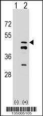 Anti-FDPS Rabbit Polyclonal Antibody (FITC (Fluorescein Isothiocyanate))