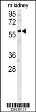 Anti-DCLRE1B Rabbit Polyclonal Antibody