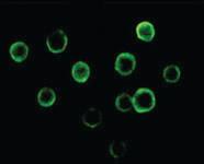 Anti-BTK Mouse Monoclonal Antibody [clone: 7F12H4]