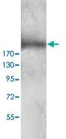 Anti-TNRC6A Rabbit Polyclonal Antibody