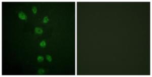 Immunofluorescence analysis of HepG2 cells using Anti-GATA4 (phospho Ser105) Antibody. The right hand panel represents a negative control, where the antibody was pre-incubated with the immunising peptide.