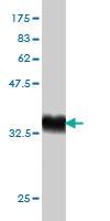 Anti-RAPGEF6 Mouse Monoclonal Antibody [clone: 2C5]