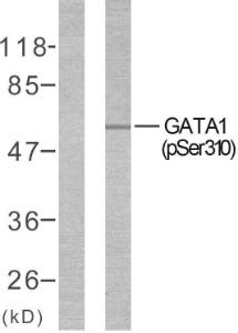 Antibody anti-GATA1 phospho SER310 100 µg