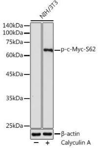 Western blot analysis of extracts of NIH/3T3 cells, using Anti-c-Myc (phospho Ser62) Antibody (A12455) at 1:1,000 dilution NIH/3T3 cells were treated by Calyculin A (100 nM) at 37°C for 30 minutes after serum-starvation overnight