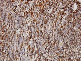 Anti-BAG1 Mouse Monoclonal Antibody [clone: 2D3]