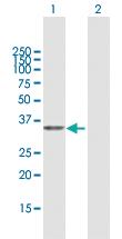 Anti-PDXK Mouse Polyclonal Antibody