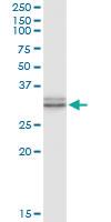 Anti-TRH Polyclonal Antibody Pair