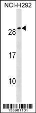 Anti-CFC1B Rabbit Polyclonal Antibody (HRP (Horseradish Peroxidase))