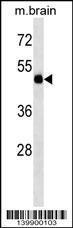 Anti-TBC1D10A Rabbit Polyclonal Antibody (HRP (Horseradish Peroxidase))