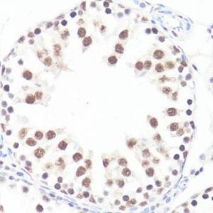 Immunohistochemistry analysis of paraffin-embedded rat testis using Anti-c-Myc (phospho Ser62) Antibody (A12455) at a dilution of 1:100 (40x lens) Perform microwave antigen retrieval with 10 mM Tris/EDTA buffer pH 90 before commencing with IHC staining protocol