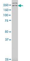 Anti-DENND4A Mouse Polyclonal Antibody