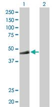 Anti-MKRN2 Rabbit Polyclonal Antibody