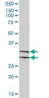 Anti-PDXK Mouse Polyclonal Antibody