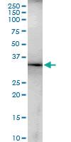 Anti-MSI2 Polyclonal Antibody Pair