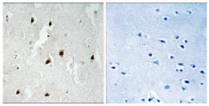 Immunohistochemical analysis of paraffin-embedded human brain using Anti-FOXO4 (phospho Ser262) Antibody The right hand panel represents a negative control, where the antibody was pre-incubated with the immunising peptide