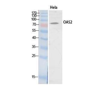 Western blot analysis of extracts from HeLa cells using Anti-OAS2 Antibody