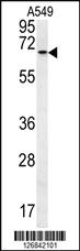 Anti-DHX58 Rabbit Polyclonal Antibody