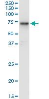 Anti-HEXA Mouse Monoclonal Antibody [clone: 3D1]