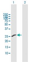 Anti-IGSF6 Mouse Polyclonal Antibody