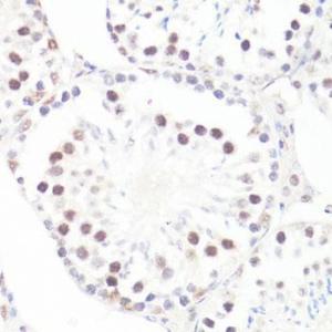 Immunohistochemistry analysis of paraffin-embedded mouse testis using Anti-c-Myc (phospho Ser62) Antibody (A12455) at a dilution of 1:100 (40x lens) Perform microwave antigen retrieval with 10 mM Tris/EDTA buffer pH 90 before commencing with IHC staining protocol