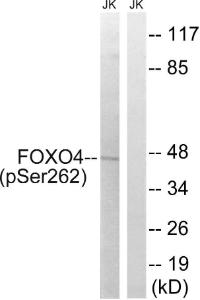 Western blot analysis of lysates from Jurkat cells treated with starved 24h using Anti-FOXO4 (phospho Ser262) Antibody The right hand lane represents a negative control, where the antibody is blocked by the immunising peptide