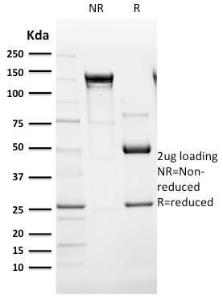 SDS-PAGE analysis of Anti-Cytokeratin 14 Antibody [SPM263] under non-reduced and reduced conditions; showing intact IgG and intact heavy and light chains, respectively SDS-PAGE analysis confirms the integrity and purity of the antibody