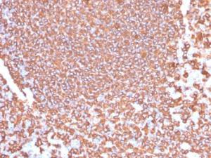 Immunohistochemical analysis of formalin-fixed, paraffin-embedded human tonsil using Anti-CD20 Antibody [IGEL/4524R]