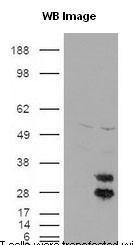 Anti-Capicua Rabbit Polyclonal Antibody (Biotin)