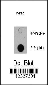 Anti-TSC1 Rabbit Polyclonal Antibody (AP (Alkaline Phosphatase))