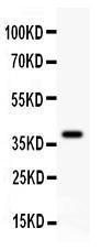 Anti-FHIT Polyclonal Antibody