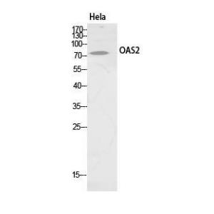 Western blot analysis of HeLa cells using Anti-OAS2 Antibody