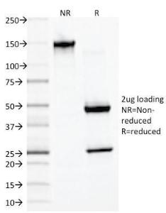 SDS-PAGE analysis of Anti-Desmin Antibody [DES/1711] under non-reduced and reduced conditions; showing intact IgG and intact heavy and light chains, respectively SDS-PAGE analysis confirms the integrity and purity of the antibody