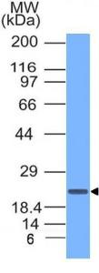 Antibody anti-CD3 EPSILON 100 µg