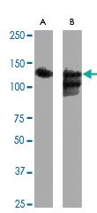 Anti-SIRT1 Rabbit Polyclonal Antibody