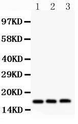 Anti-FHIT Polyclonal Antibody