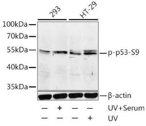 Western blot analysis of extracts of 293 and HT-29 cells, using Anti-p53 (phospho Ser9) Antibody (A12456) at 1:1000 dilution