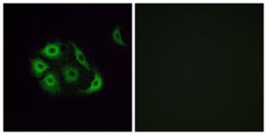 Anti-OR4P4 antibody