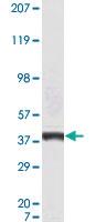 Anti-CACYBP Mouse Monoclonal Antibody [clone: 7D11]