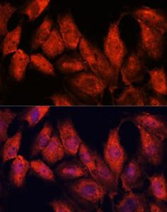 Anti-ATF5 Rabbit Polyclonal Antibody