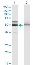 Anti-HEXA Mouse Monoclonal Antibody [clone: 3D1]