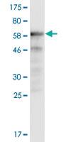 Anti-EV71 VP1 Mouse Monoclonal Antibody [clone: 3D7]