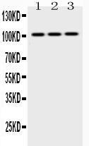 Anti-HK2 Rabbit Polyclonal Antibody