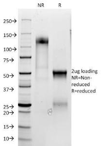 Antibody anti-CD3 EPSILON 100 µg