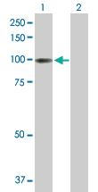 Anti-ITIH1 Mouse Polyclonal Antibody