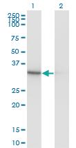 Anti-PDXK Mouse Monoclonal Antibody [clone: 4G6]