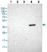 Anti-ZDHHC20 Rabbit Polyclonal Antibody