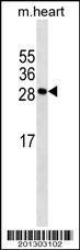 Anti-MYOG Mouse Monoclonal Antibody (FITC (Fluorescein Isothiocyanate)) [clone: 304CT11.6.1]