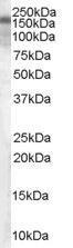 Anti-TSC1 Goat Polyclonal Antibody